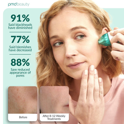 PMD Beauty Personal Microderm Classic - At-Home Use, Facial Exfoliator Tool, Microdermabrasion Machine Kit for Face and Body Skincare