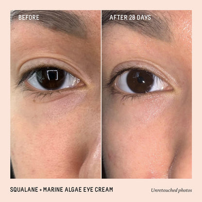 BIOSSANCE Squalane and Marine Algae Eye Cream - Anti-Aging Under Eye Cream for Fine Lines, Wrinkles, and Puffiness - Hydrating & Lifting Formula with Hyaluronic Acid and Paracress Extract - 0.5 Ounce