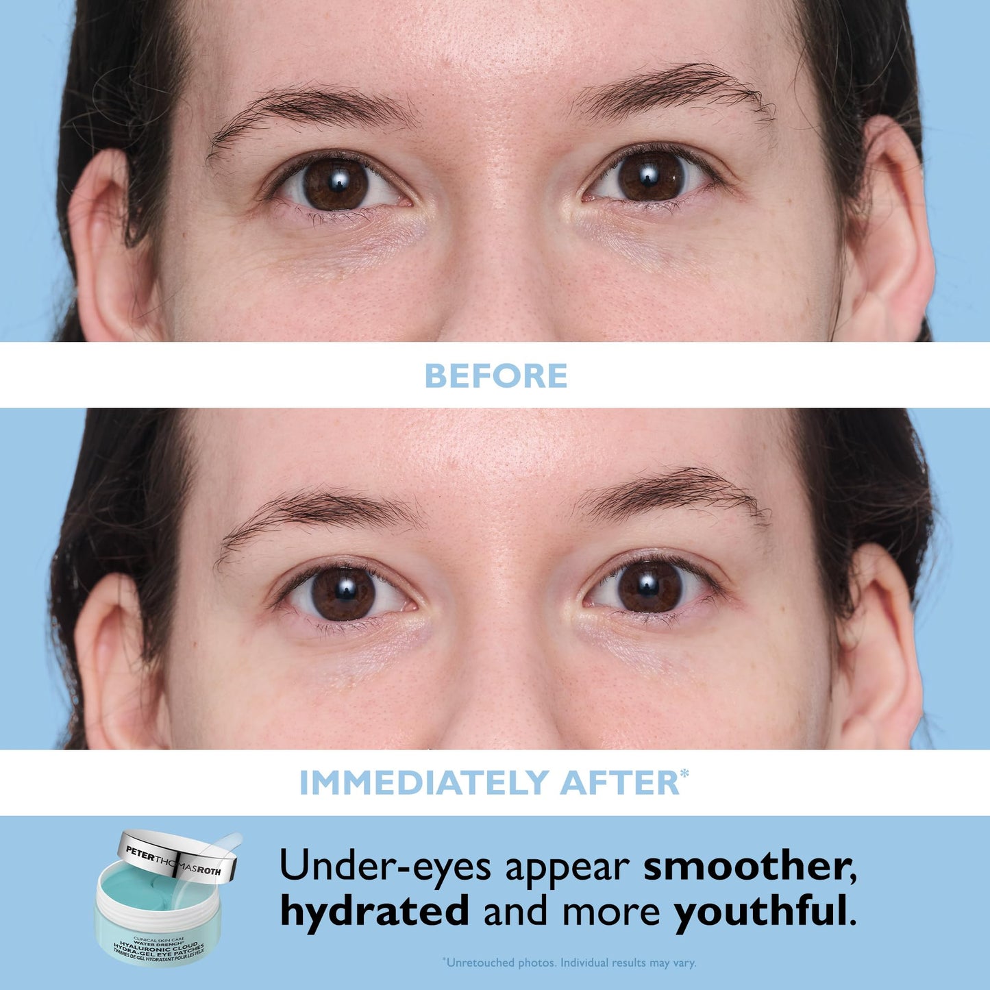 Peter Thomas Roth | Full-Size Vitamin C & Hyaluronic Eye Patches 2-Piece Kit