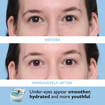 Peter Thomas Roth | Full-Size Vitamin C & Hyaluronic Eye Patches 2-Piece Kit