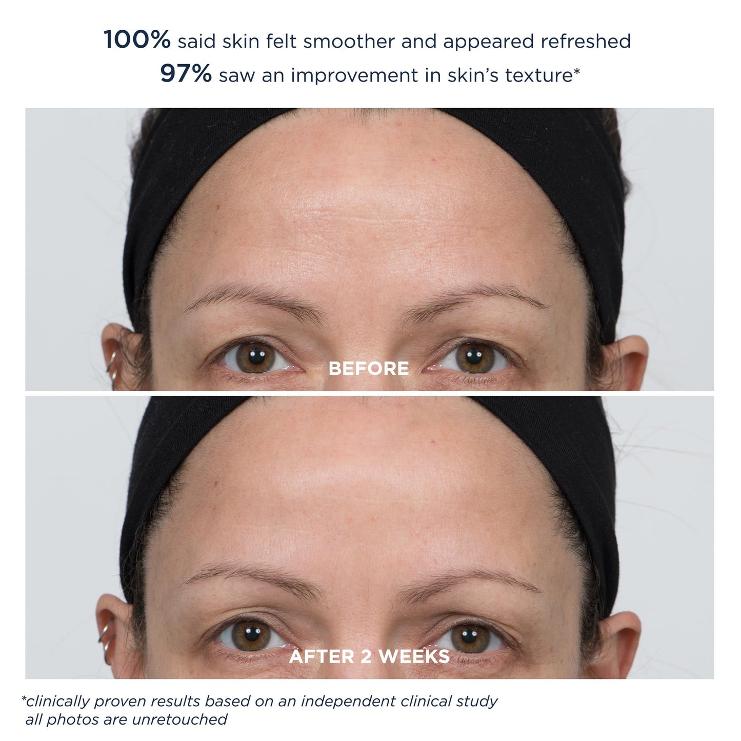 M-61 PowerGlow Peel Extra Strength 20% | Professional Strength Exfoliating Facial Peel With Advanced 20% Glycolic Acid