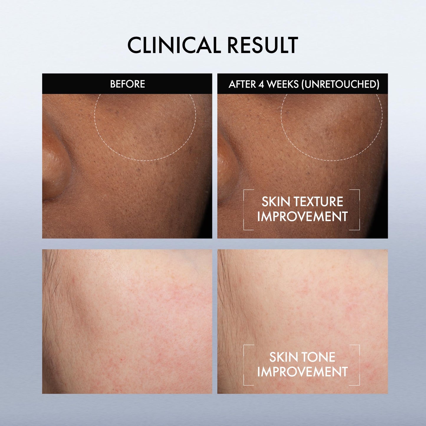 AMOREPACIFIC Resurfacing Hydrating Smoothing Strengthening