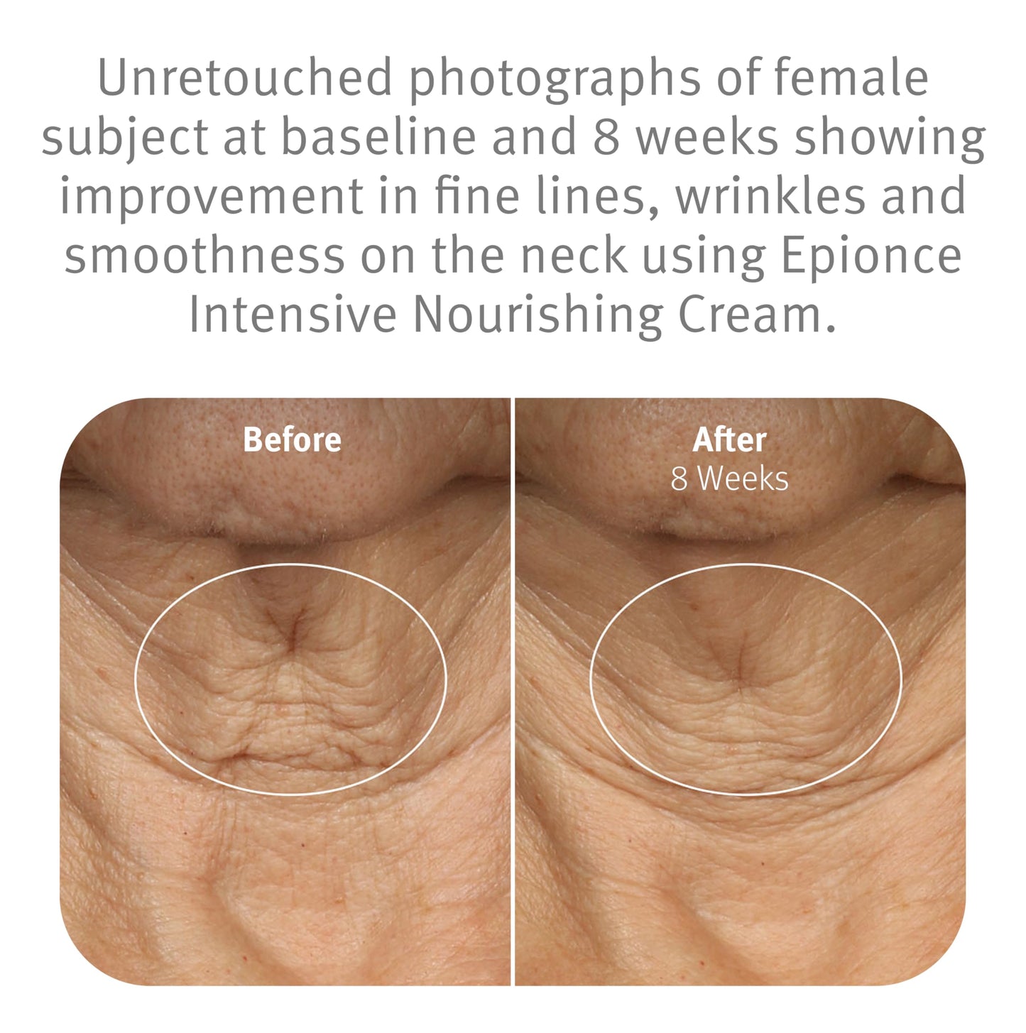 Epionce Intensive Nourishing Cream – Rich Anti-Aging Moisturizer for Face, Neck & Décolletage | Ceramides, Glycerin & Squalene | Targets Fine Lines, Dark Spots & Dryness | Dermatologist Skincare
