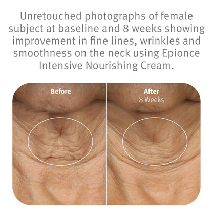 Epionce Intensive Nourishing Cream – Rich Anti-Aging Moisturizer for Face, Neck & Décolletage | Ceramides, Glycerin & Squalene | Targets Fine Lines, Dark Spots & Dryness | Dermatologist Skincare