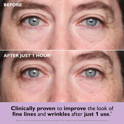Peter Thomas Roth | Instant FIRMx® Collagen Tightening Eye Patches | Eye Patches For Firming Under-Eye Bags & Wrinkles | Eye Masks For Puffiness