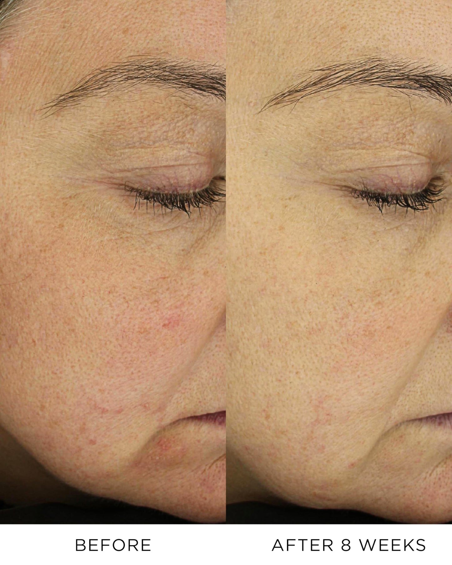 Absolute Nourishing Lift Oil Doses