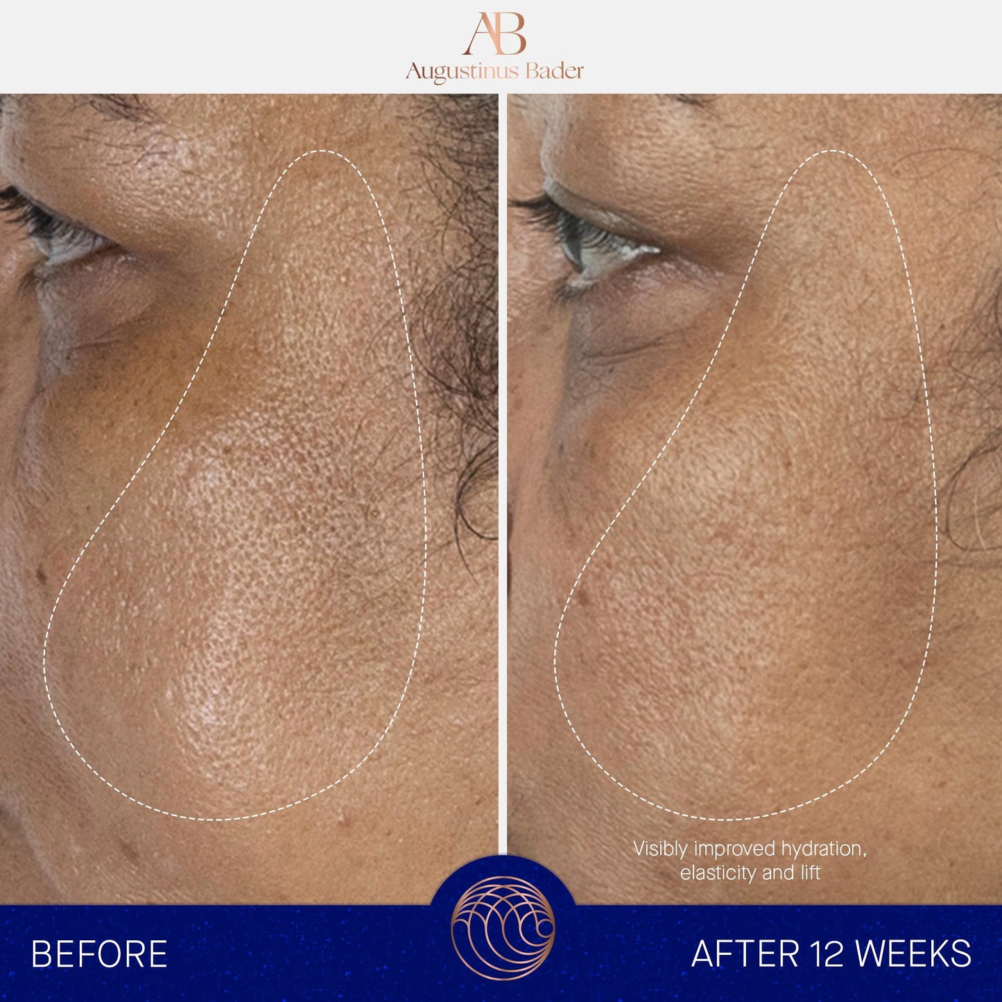 Augustinus Bader The Serum – Luxury Hydrating Anti-Aging Face Serum – Boosts Firmness, Smooths Fine Lines & Evens Skin Tone