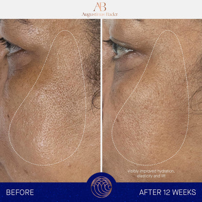 Augustinus Bader The Serum – Luxury Hydrating Anti-Aging Face Serum – Boosts Firmness, Smooths Fine Lines & Evens Skin Tone