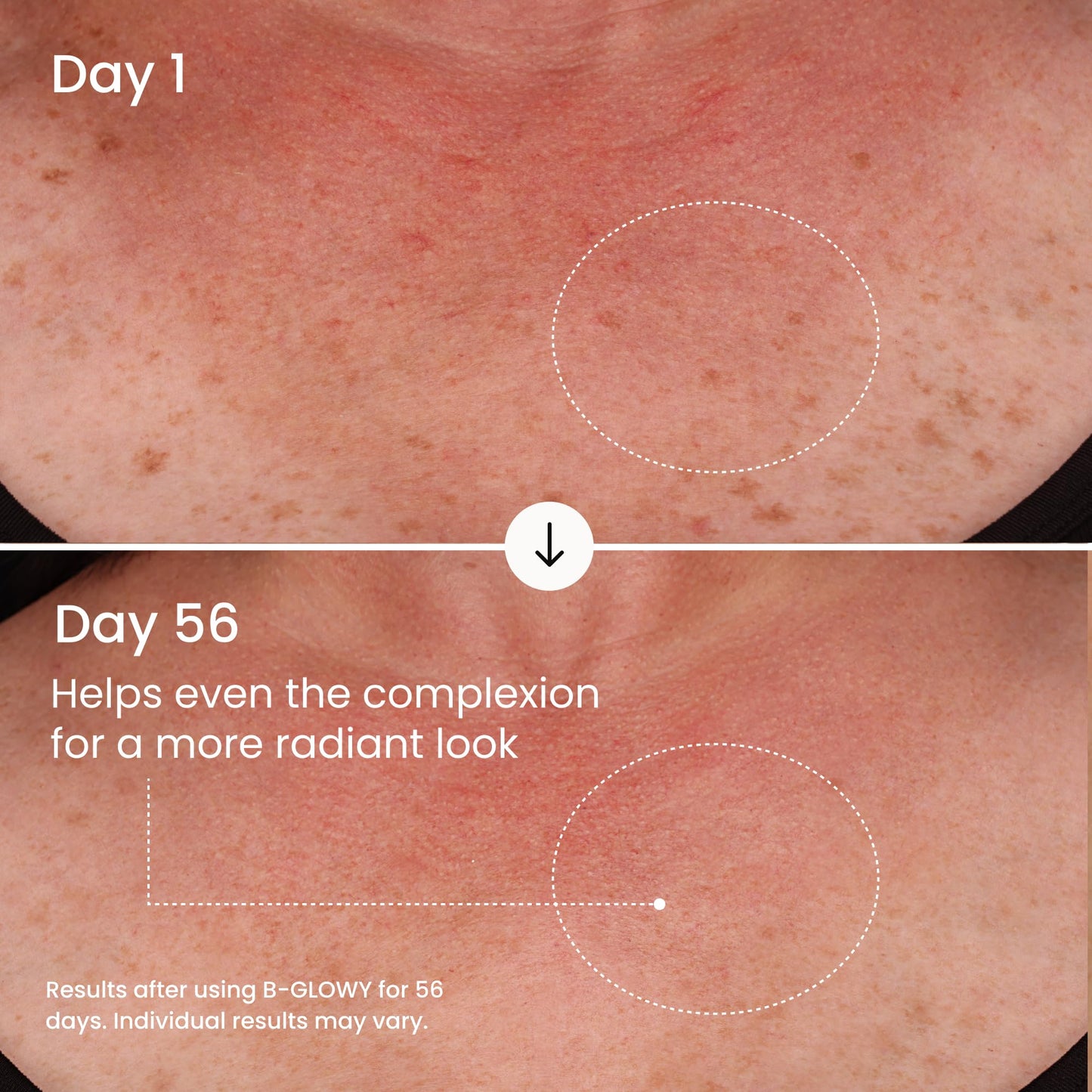 MAËLYS B-GLOWY Brightening Body Serum for Dark Spots - Supports Even Looking Skin - Peptide Formula with Niacinamide & Meadowfoam Oil (3.4 Fl Oz)