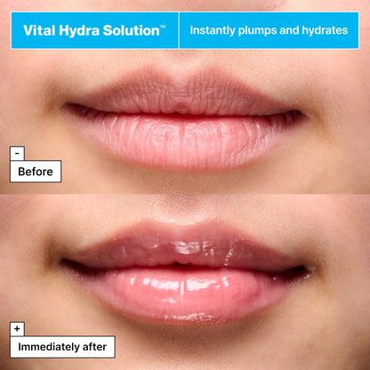 Dr.Jart+ Vital Hydra Solution Jelly Bear Korean Overnight Lip Mask with Hyaluronic Acid | Korean Skin Care, 0.59 Oz