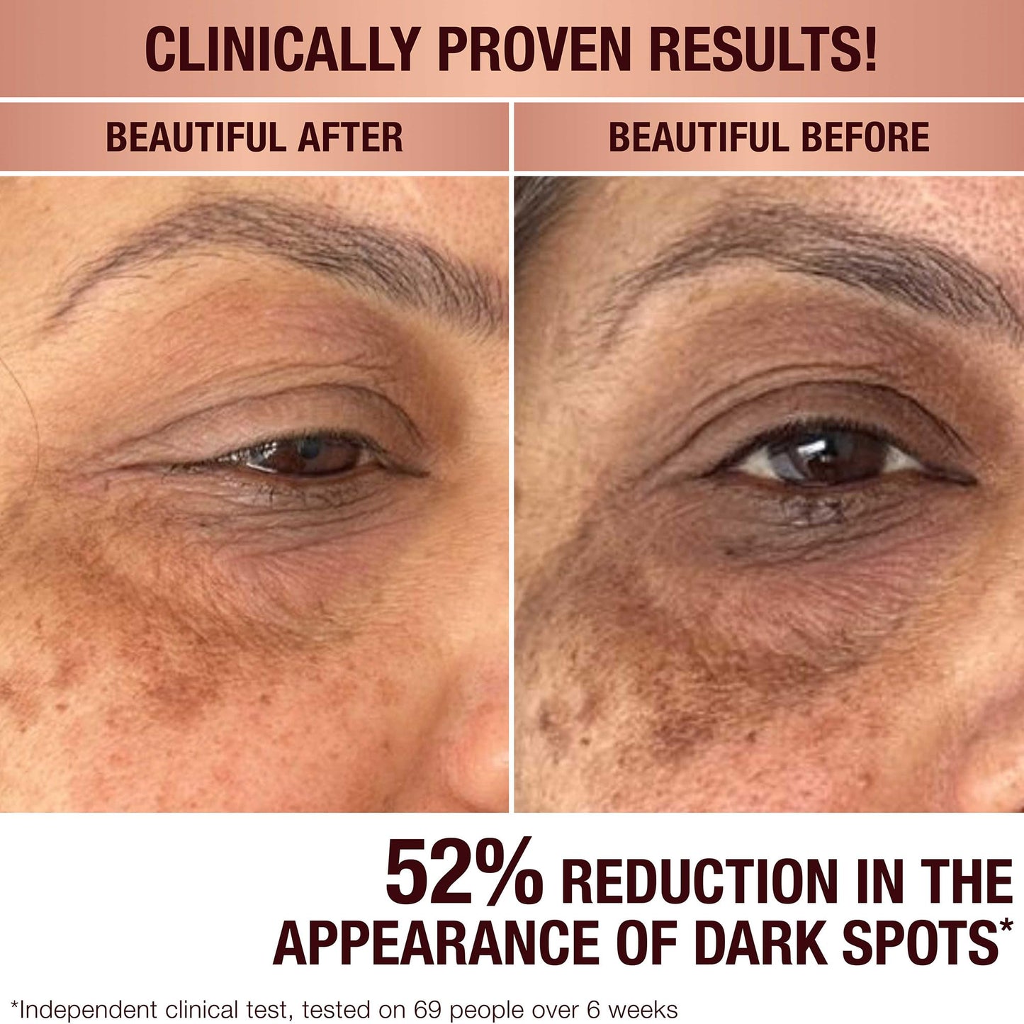 Charlotte Tilbury Radiance Recovery Dark Spot Serum - Tranexamic Acid & Vitamin C Serum for Brighter Looking Under Eyes, Redness, Uneven Skin Tone - Treatment to Reduce Appearance of Aging Skin