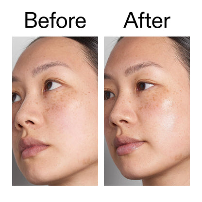 The INKEY List Hyaluronic Acid Serum - Delivers Instant and Lasting Deep Hydration, Plumps Dry Skin, Vegan & Suitable For All Skin Types
