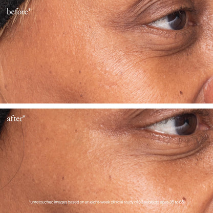 goop Beauty 3x Retinol Eye Lift Serum | Fine Lines and Wrinkles Treatment | 0.5 fl oz
