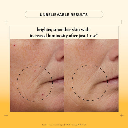 philosophy microdelivery vitamin c resurfacing peel kit - with lactic acid & sunflower seed oil - two-step treatment to smooth rough texture, even skin tone and minimize the appearance of fine lines