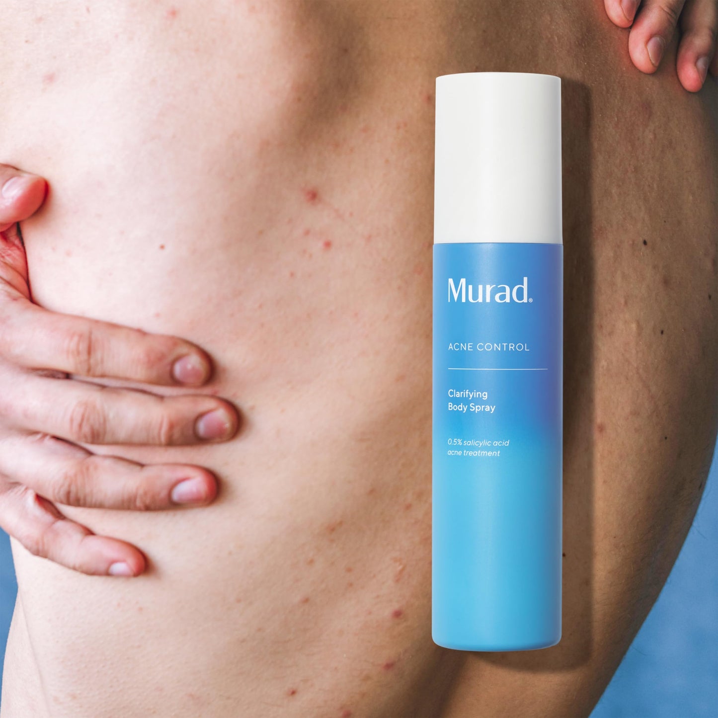 Murad Clarifying Body Spray – Salicylic Acid Daily Treatment for Bacne, Clears and Prevents Body Acne Breakouts across Back, Shoulders, Arms & All Over Without Over-Drying Skin