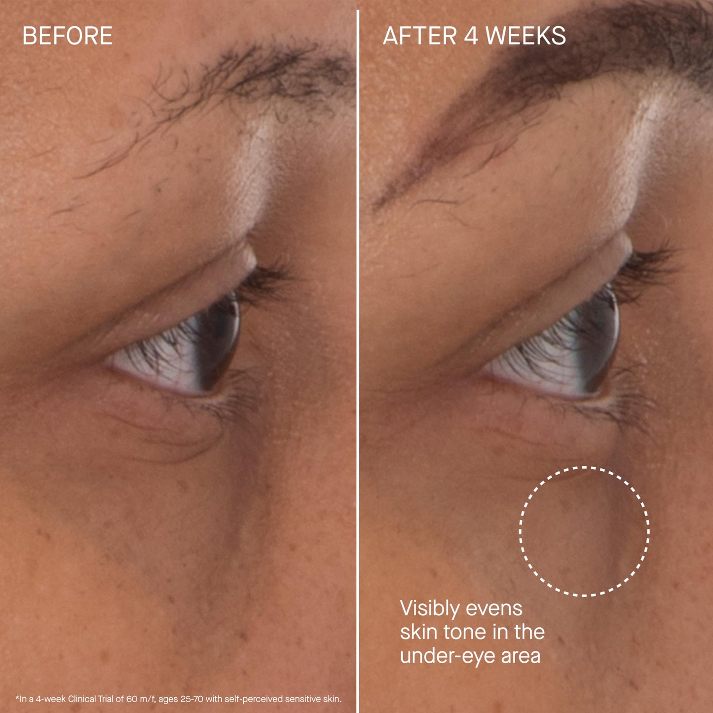 Augustinus Bader The Eye Patches – Luxury Hydrating & Anti-Aging Under-Eye Treatment – Reduces Puffiness, Smooths Fine Lines & Brightens Dark Circles – Soothing, Restorative Formula