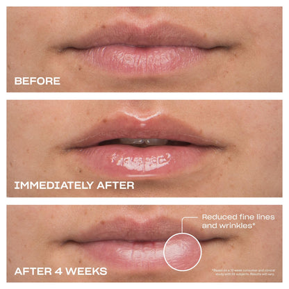 BABE ORIGINAL Cloud 9 Peptide Lip Serum | Daily Lip Treatment with Cloudberry Oil, Mushroom Extracts, Hyaluronic Acid for Dryness & Fine Lines | Smoothing & Hydrating Lip Moisturizer | Vegan Lip Care