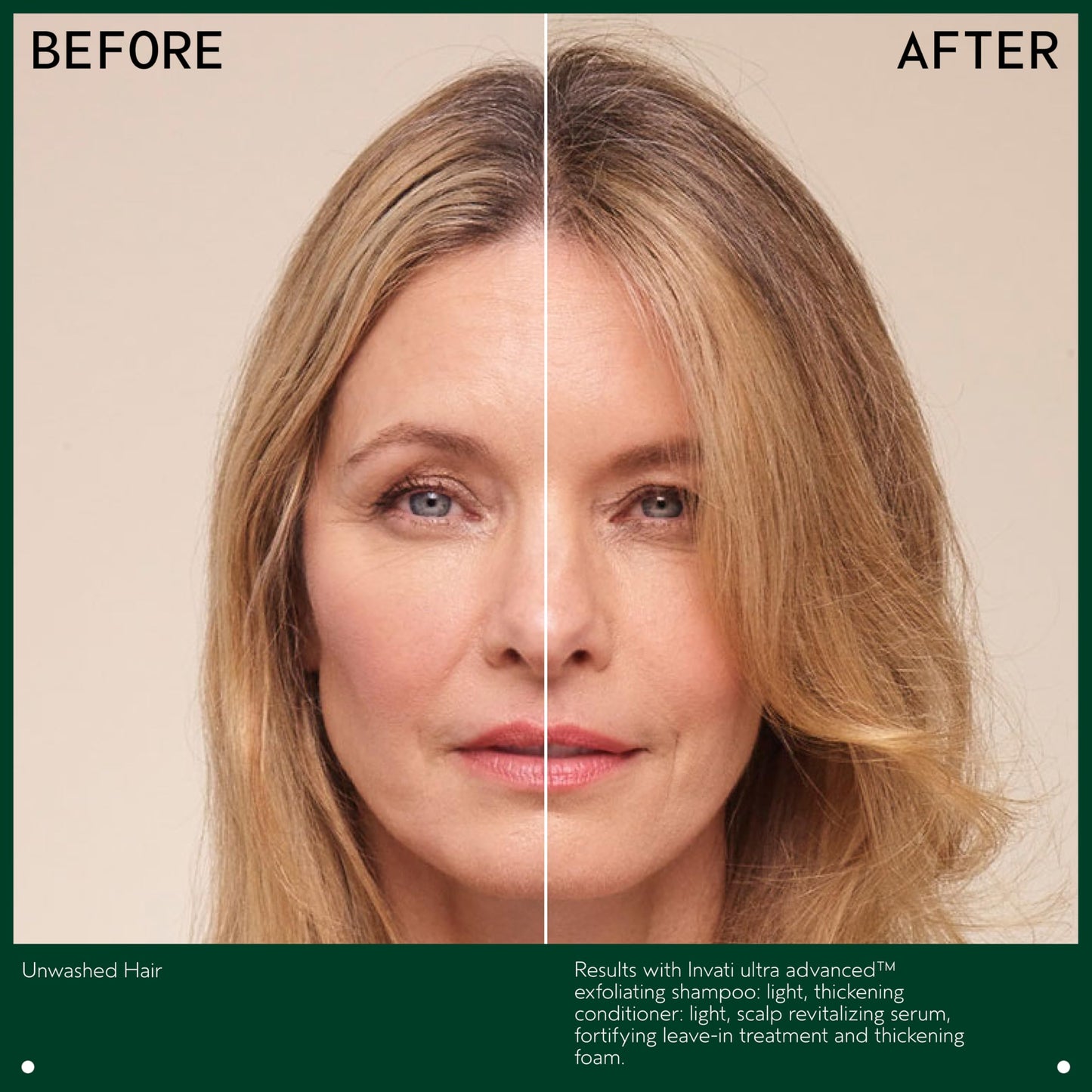 Aveda Invati Ultra Advanced Thickening Conditioner Light | Step 2 of 4 | Reduces Hair Loss by 77% | for Fine to Medium Thinning Hair Types | Normal to Oily Scalp | 96% Naturally Derived*