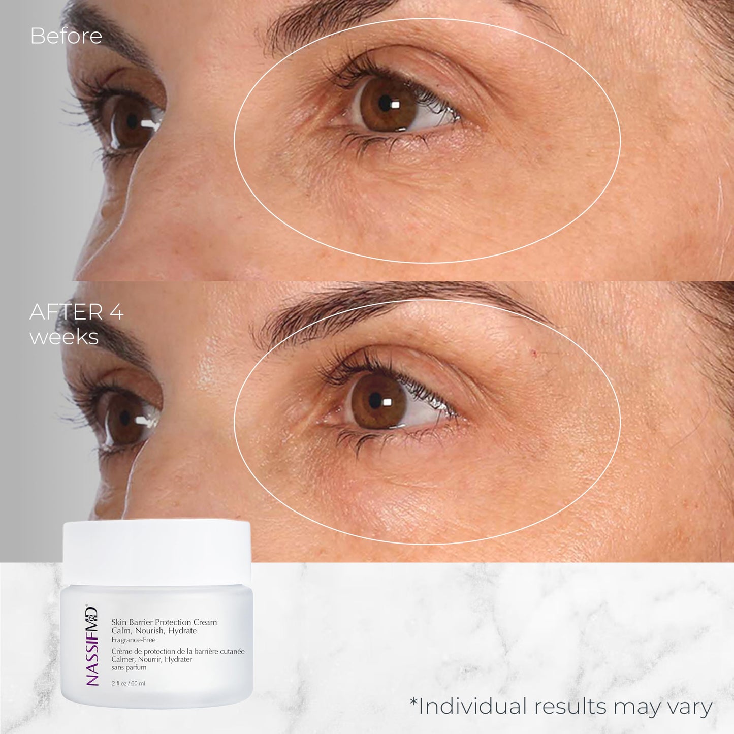 NassifMD Skin Barrier Protection Cream with Centella Asiatica - Healing Moisturizer for Sensitive & Post-Treatment Skin - Reduces Redness, Plumps Fine Lines