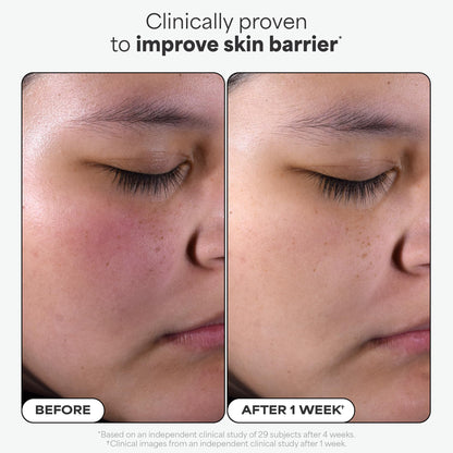 Paula's Choice SKIN PERFECTING 2% BHA Liquid Exfoliant with Salicylic Acid, Facial Polish for Enlarged Pores, Wrinkles & Fine Lines, Suitable for Blackhead-Prone Skin, Fragrance-Free