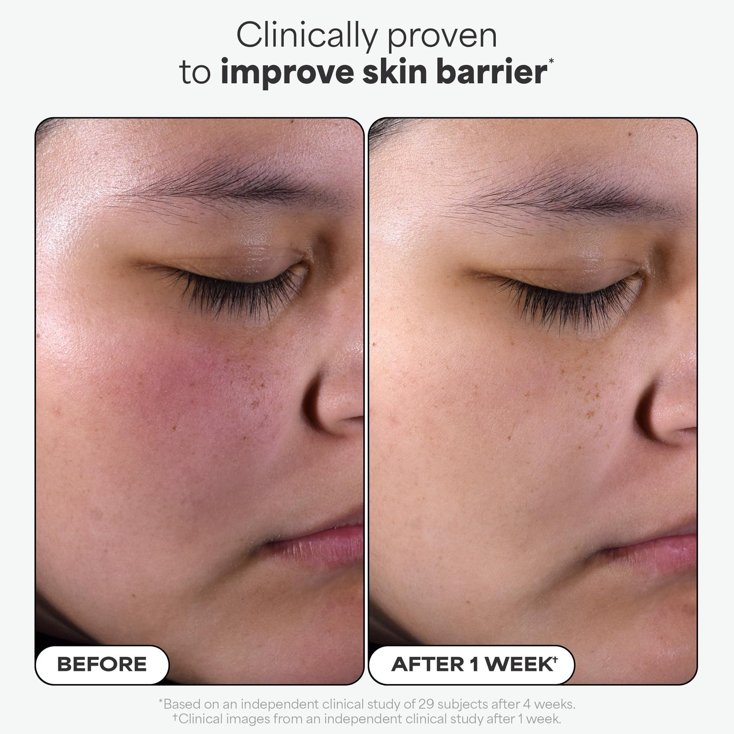 Paula's Choice SKIN PERFECTING 2% BHA Salicylic Acid Exfoliating Pads - Facial Exfoliant Pads for Blackheads, Enlarged Pores, Wrinkles & Fine Lines