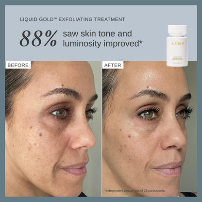 Alpha-H Liquid Gold Exfoliating Treatment 5% Glycolic Acid 100ml - Brighten, Even Tone, Smooth Texture, Reduce Appearance of Fine Lines - At-Home Skin Renewal for All Skin Types