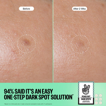 PEACE OUT Microneedling Dark Spot Brightening Dots, Targeted Dark Spot Corrector Patches for Face with Dissolving Microneedles, 12 Count