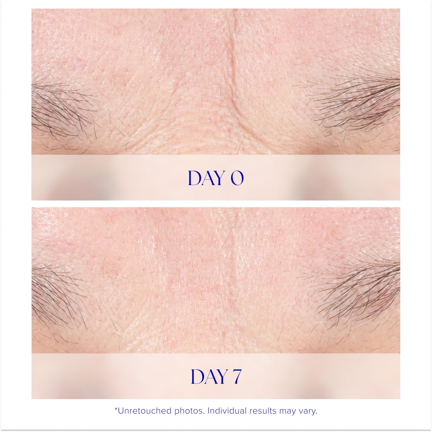 iS CLINICAL Youth Intensive Crème. Anti-aging, firming face cream. Reduces appearance of fine fines and wrinkles.