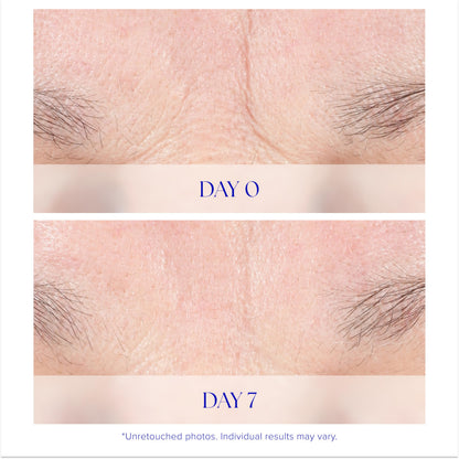 iS CLINICAL Youth Intensive Crème. Anti-aging, firming face cream. Reduces appearance of fine fines and wrinkles.