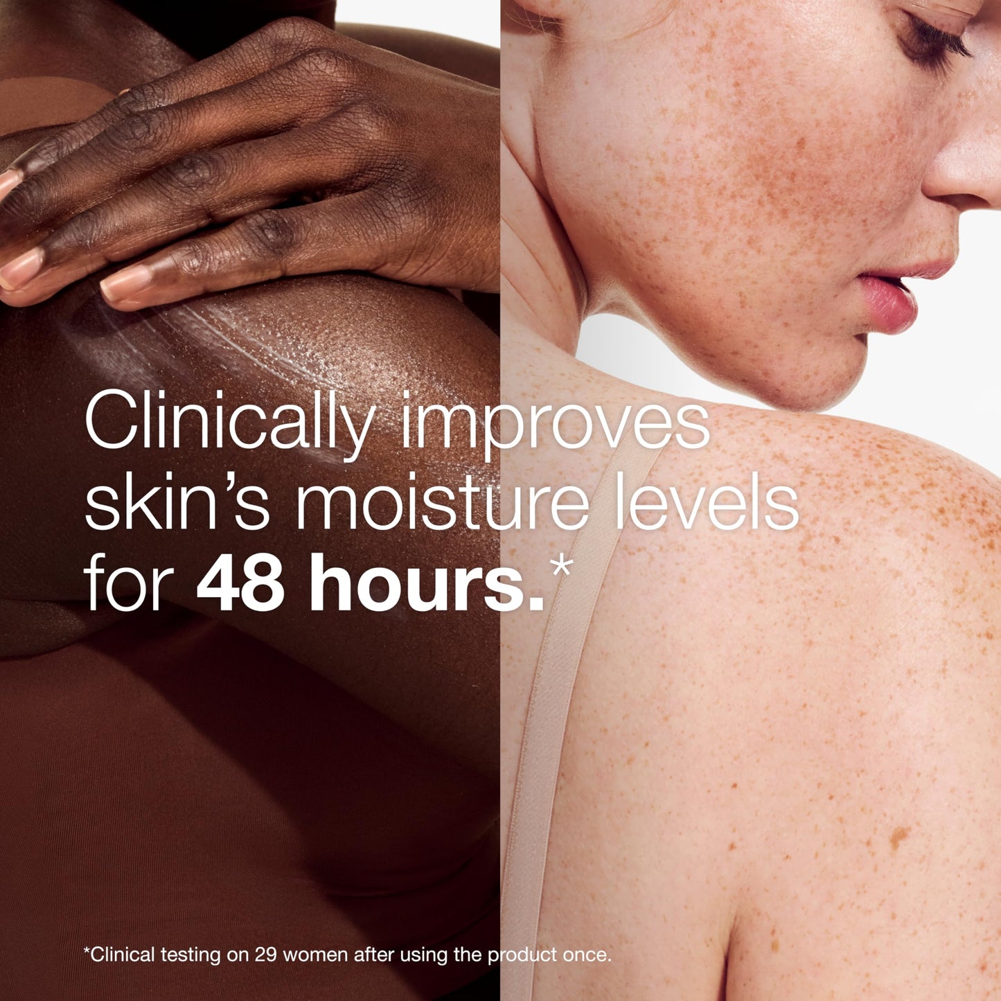 Clinique Moisture Surge Body Hydrator Lotion with Aloe Bioferment, Hyaluronic Acid + Glycerin | Hydrating, Moisturizing + Lightweight, 6.7 Fl Oz