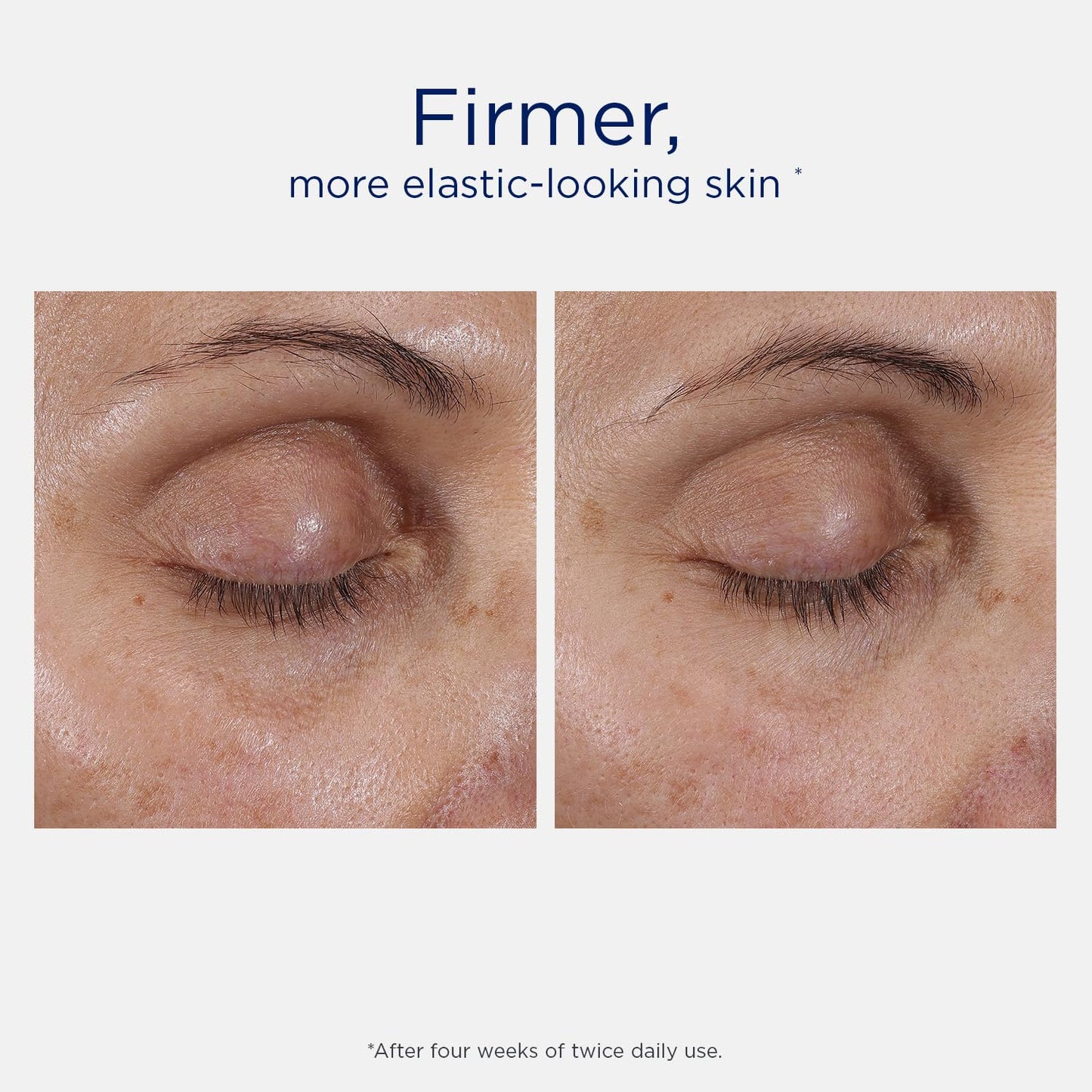 NEOSTRATA SKIN ACTIVE Intensive Eye Therapy, Anti Aging Under Eye Ceam, Treats Dark Circles, Puffiness, Fine Lines and Wrinkles with Hyaluronic Acid, Peptides and Bakuchiol, 0.5 oz