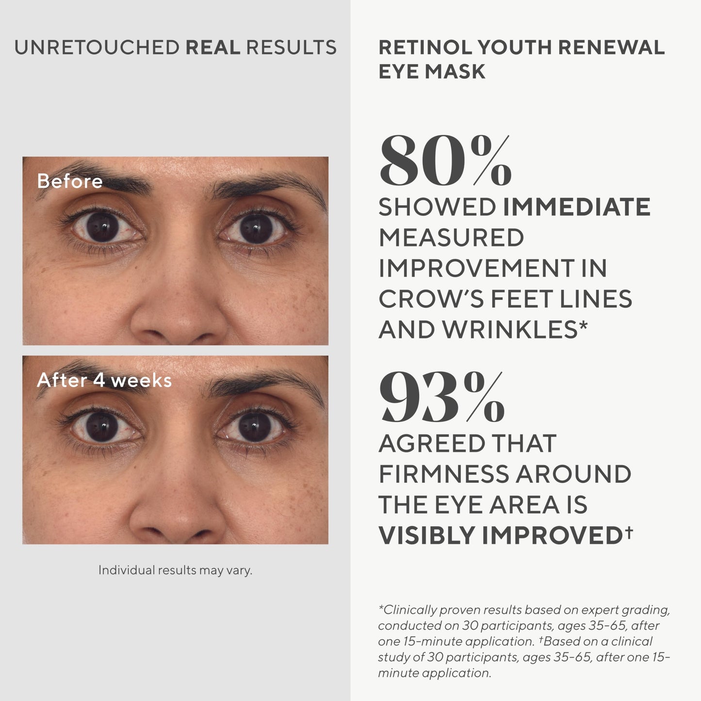 Murad Retinol Youth Renewal Eye Masks – No-Slip Full Absorption Bio-Cellulose Under Eye Patches with Retinol, Blue Agave, & Passionfruit for Lines, Wrinkles, Puffiness