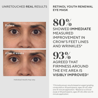 Murad Retinol Youth Renewal Eye Masks – No-Slip Full Absorption Bio-Cellulose Under Eye Patches with Retinol, Blue Agave, & Passionfruit for Lines, Wrinkles, Puffiness