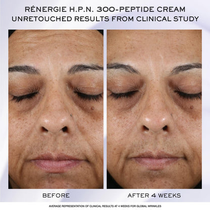 Lancôme Rénergie H.C.F. Triple Serum Discovery Set