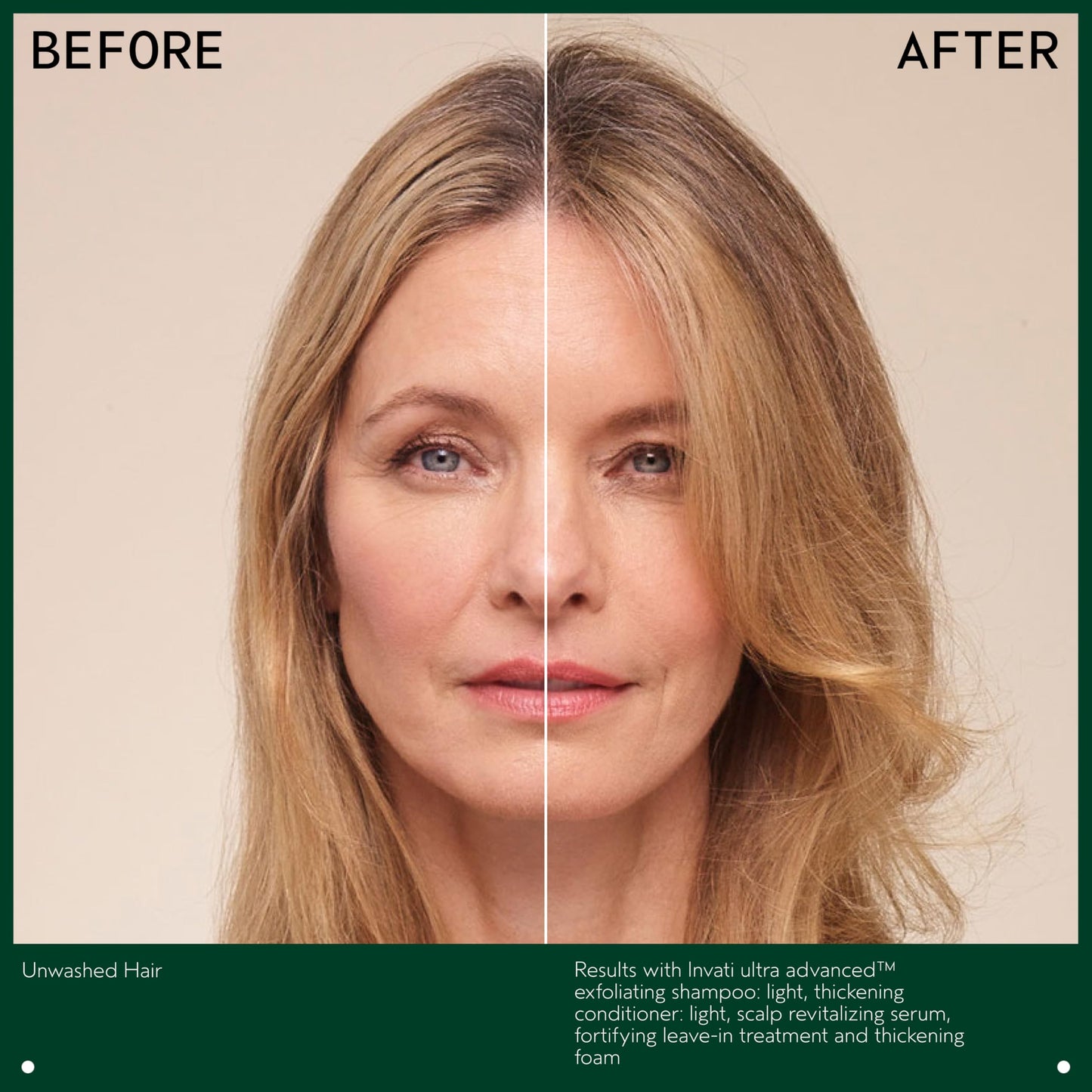 Aveda Invati Ultra Advanced Fortifying Leave-In Treatment | Step 4 of 4 | Reduces Hair Loss by 77% | Strengthens Thinning Hair | AntiFrizz Detangles Heat Protectant | 98% Naturally Derived*