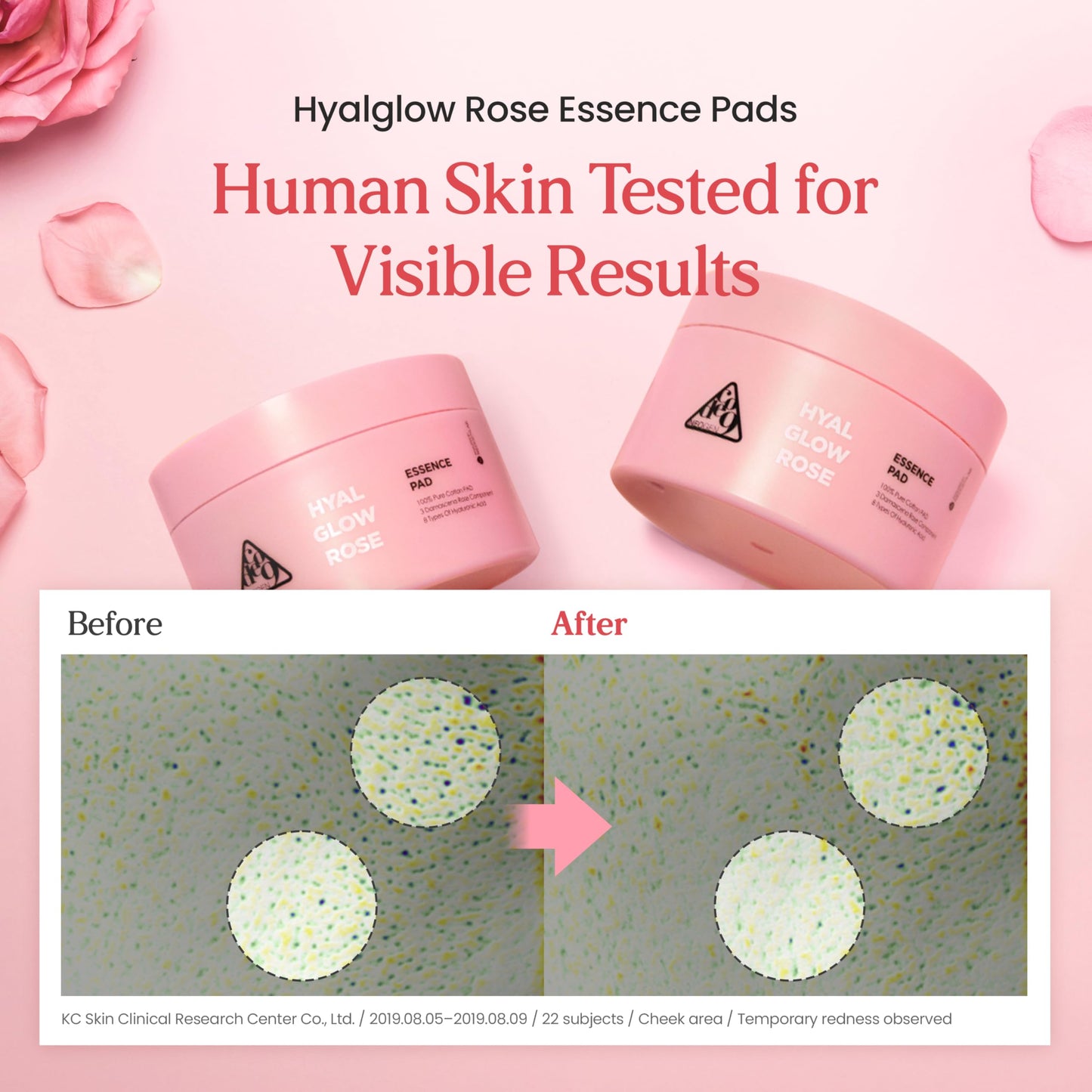 Neogen DERMALOGY Hyal Glow Rose Essence Pad – Hydrating, Firming & Radiance Boosting Toner Pads Infused with Rose Water, Niacinamide, Adenosine & 8 Types of Hyaluronic Acid 70 Pads / 4.6fl.oz