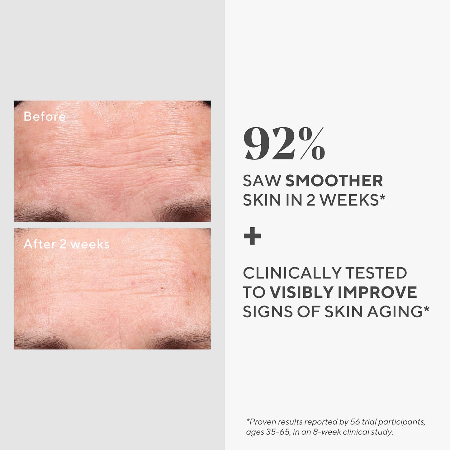 Murad Retinol Youth Renewal Serum - Fast-Acting Retinol Treatment with Swertia & Hyaluronic Acid for Visible Anti-Aging Results - Tri-active Technology Gently Reduces Wrinkles & Firms Skin