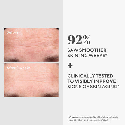 Murad Retinol Youth Renewal Serum - Fast-Acting Retinol Treatment with Swertia & Hyaluronic Acid for Visible Anti-Aging Results - Tri-active Technology Gently Reduces Wrinkles & Firms Skin