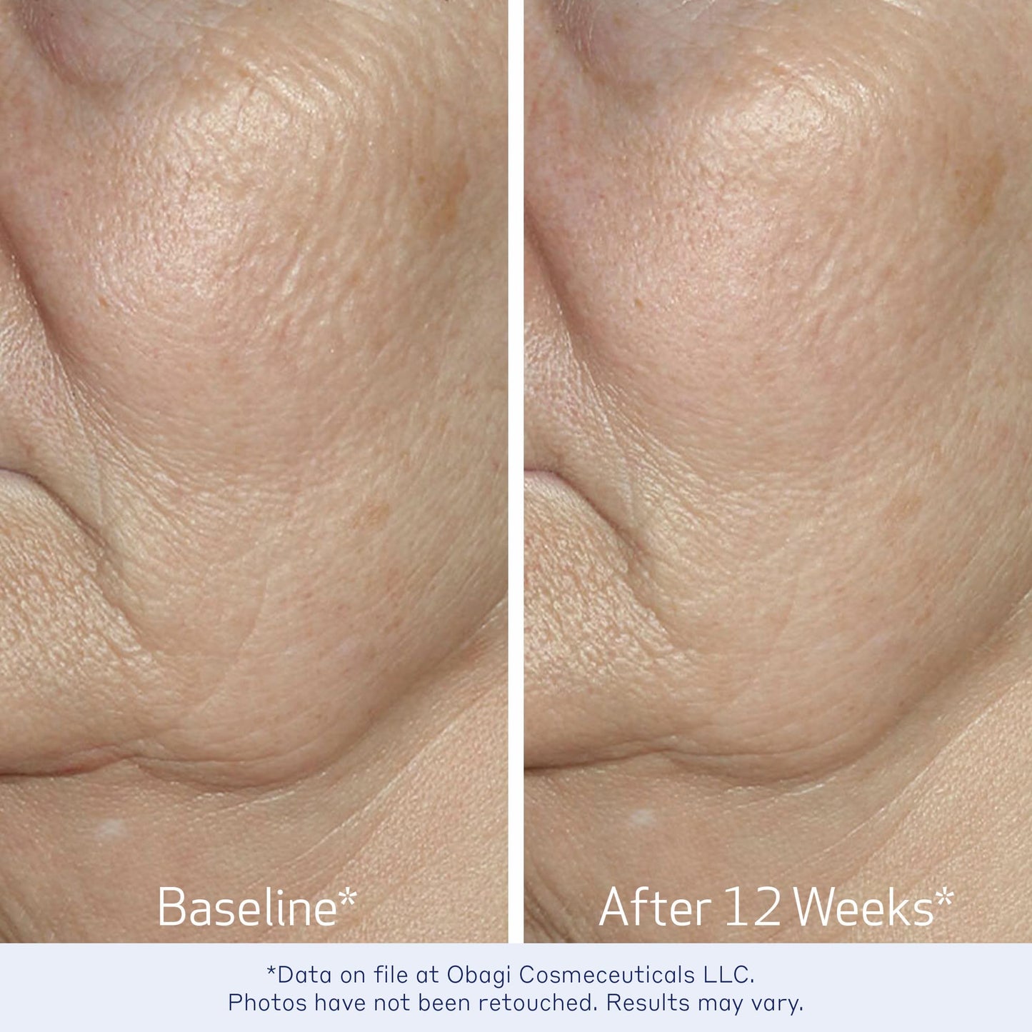 Obagi ELASTIderm Facial Serum – Firming Face Serum with Patented Bi-Mineral Contour Complex Clinically Proven to Target Signs Of Skin Aging
