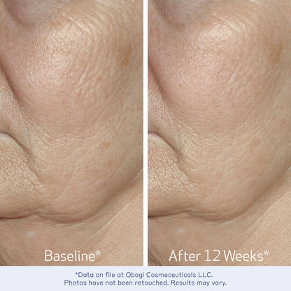 Obagi ELASTIderm Facial Serum – Firming Face Serum with Patented Bi-Mineral Contour Complex Clinically Proven to Target Signs Of Skin Aging