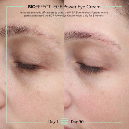 BIOEFFECT EGF Power Eye Cream | Intensive Age-Defying Eye Treatment with Epidermal Growth Factor + Bakuchiol + Niacinamide for Wrinkles, Dark Circles & Puffiness | 15 mL / 0.51 oz