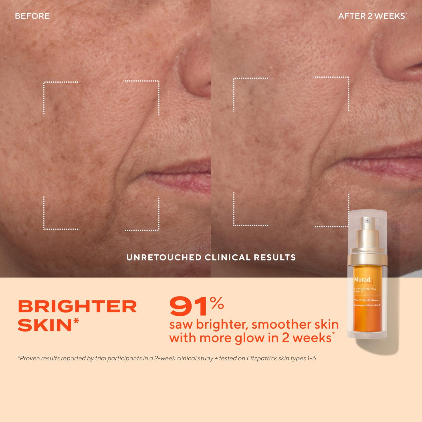 Murad Brighten Trial Kit – Vitamin C Skincare Set for Brighten & Even Tone - Travel-Friendly Kit for Radiant, Even-Toned Skin