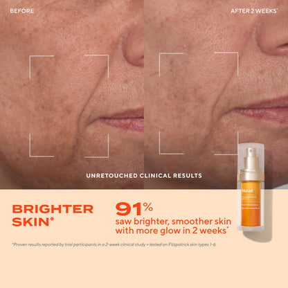Murad Brighten Trial Kit – Vitamin C Skincare Set for Brighten & Even Tone - Travel-Friendly Kit for Radiant, Even-Toned Skin