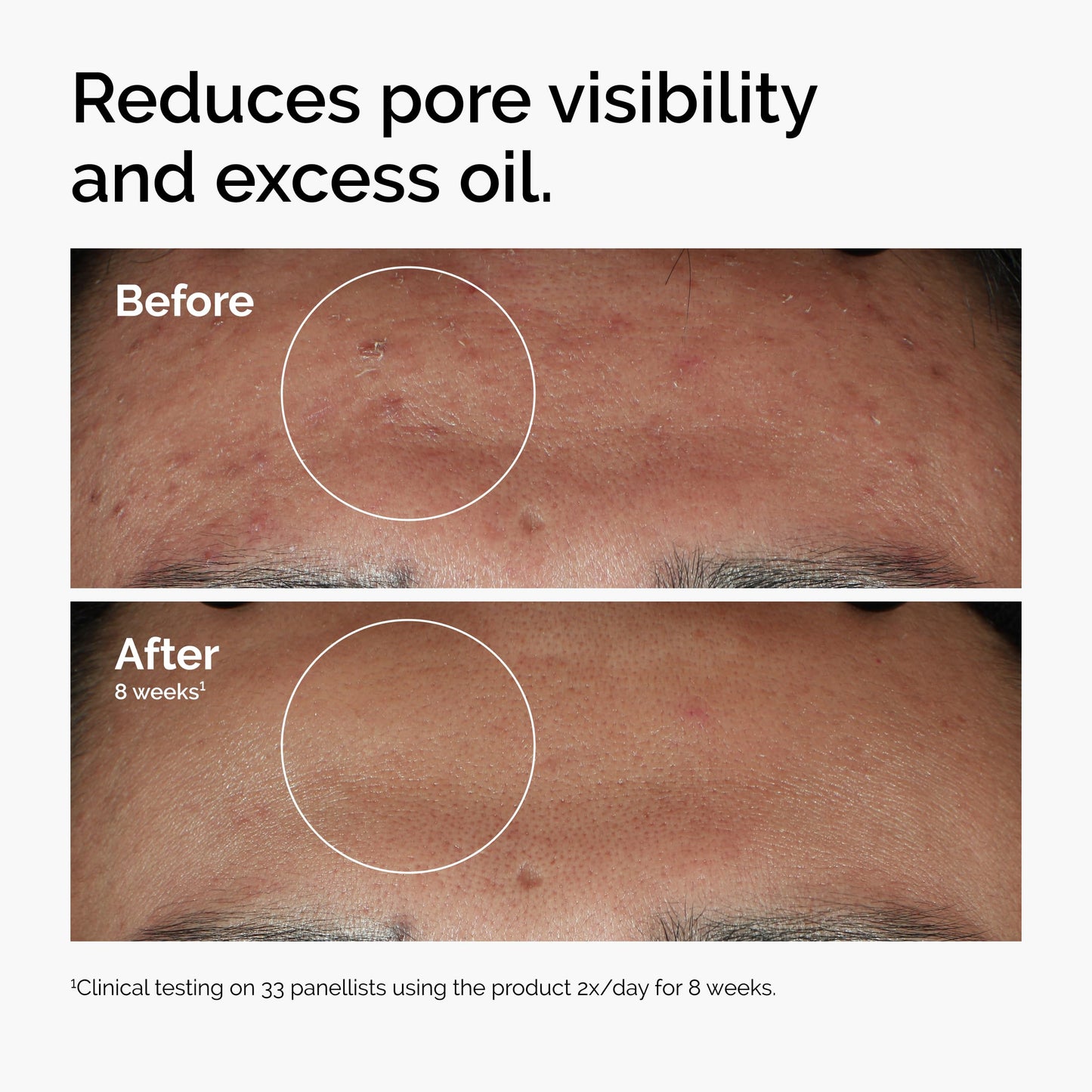 The Ordinary Serum Favorites Set – Hyaluronic Acid 2% + B5, Niacinamide 10% + Zinc 1%, Caffeine Solution 5% – Eye and Face Serums for Hydrating, Brightening & Pore-Minimizing Skin Care