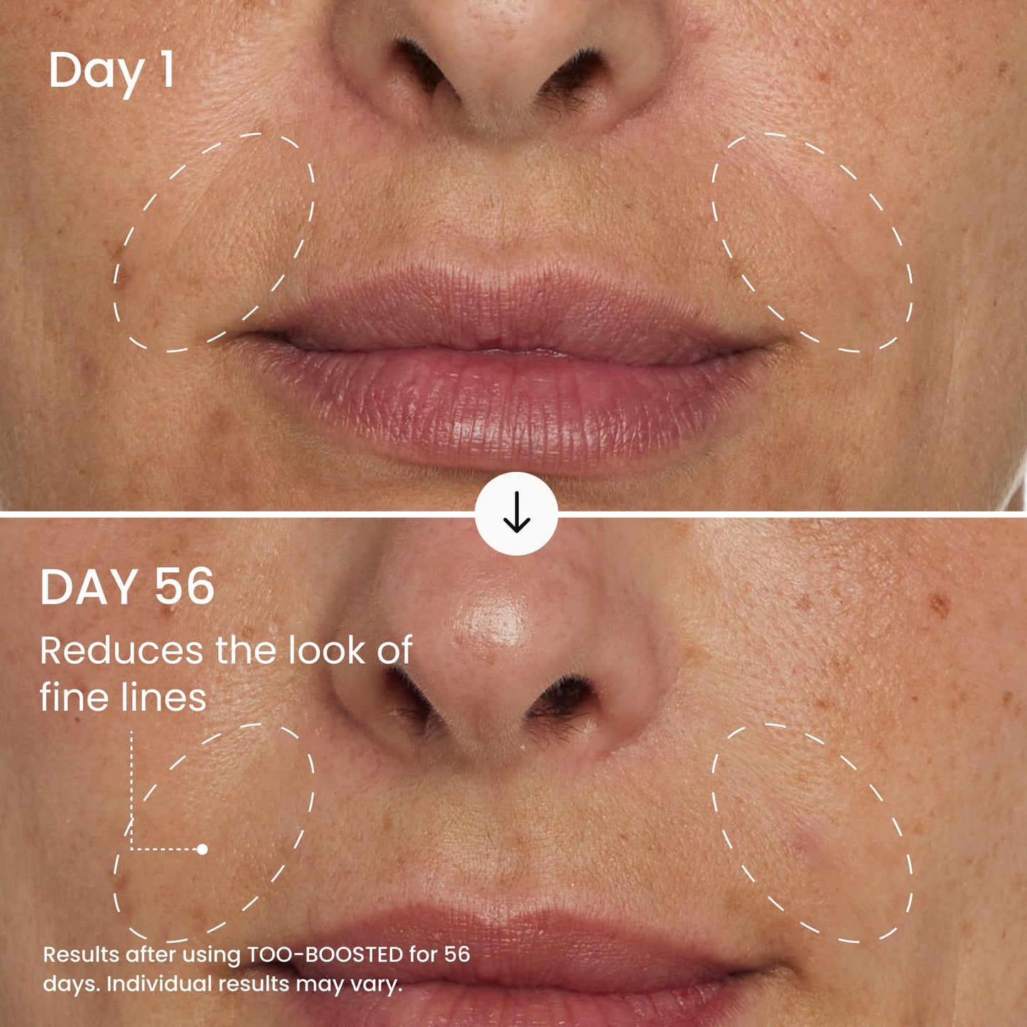 MAËLYS TOO-BOOSTED Face Filling Cream - Hydrating Facial Moisturizer with Hyaluronic Acid for Visibly Plumper Skin - Clinically Tested Anti Aging Face Cream for Women (1.0 Fl Oz)
