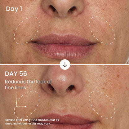 MAËLYS TOO-BOOSTED Face Filling Cream - Hydrating Facial Moisturizer with Hyaluronic Acid for Visibly Plumper Skin - Clinically Tested Anti Aging Face Cream for Women (1.0 Fl Oz)