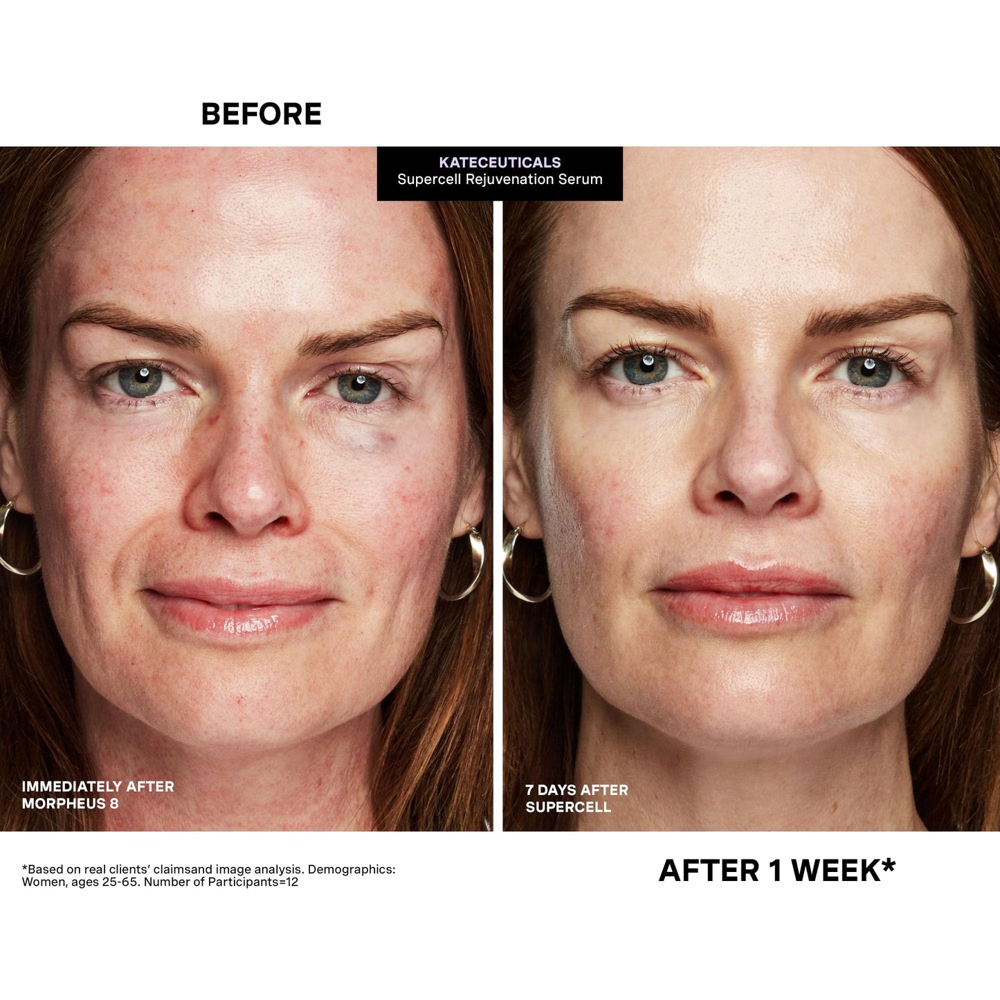Kate Somerville KateCeuticals® SuperCell – Rejuvenation Peptide Serum to Repair Damaged Skin and Reduce Fine Lines and Wrinkles, 1 Fl Oz