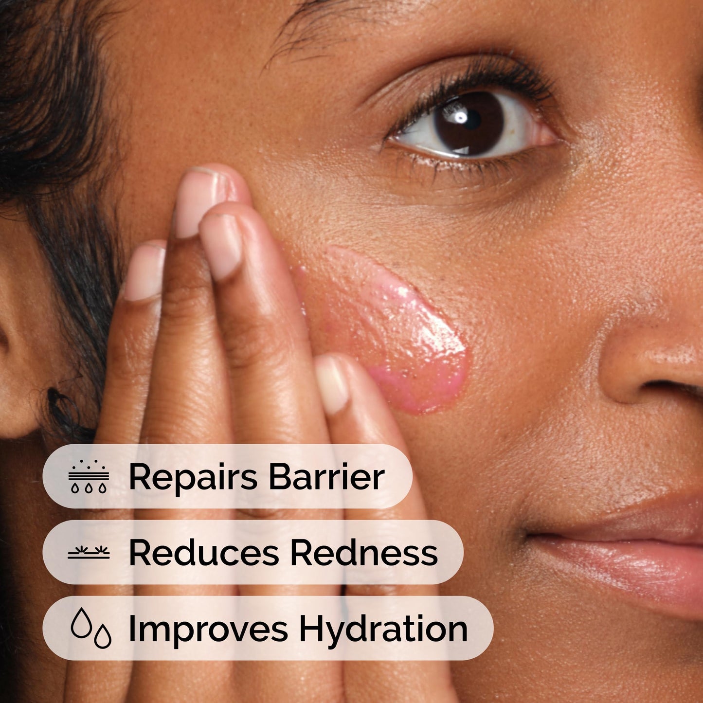 The Ordinary Soothing & Barrier Support Serum, Redness-Reducing & Hydrating Solution for Skin Barrier Recovery