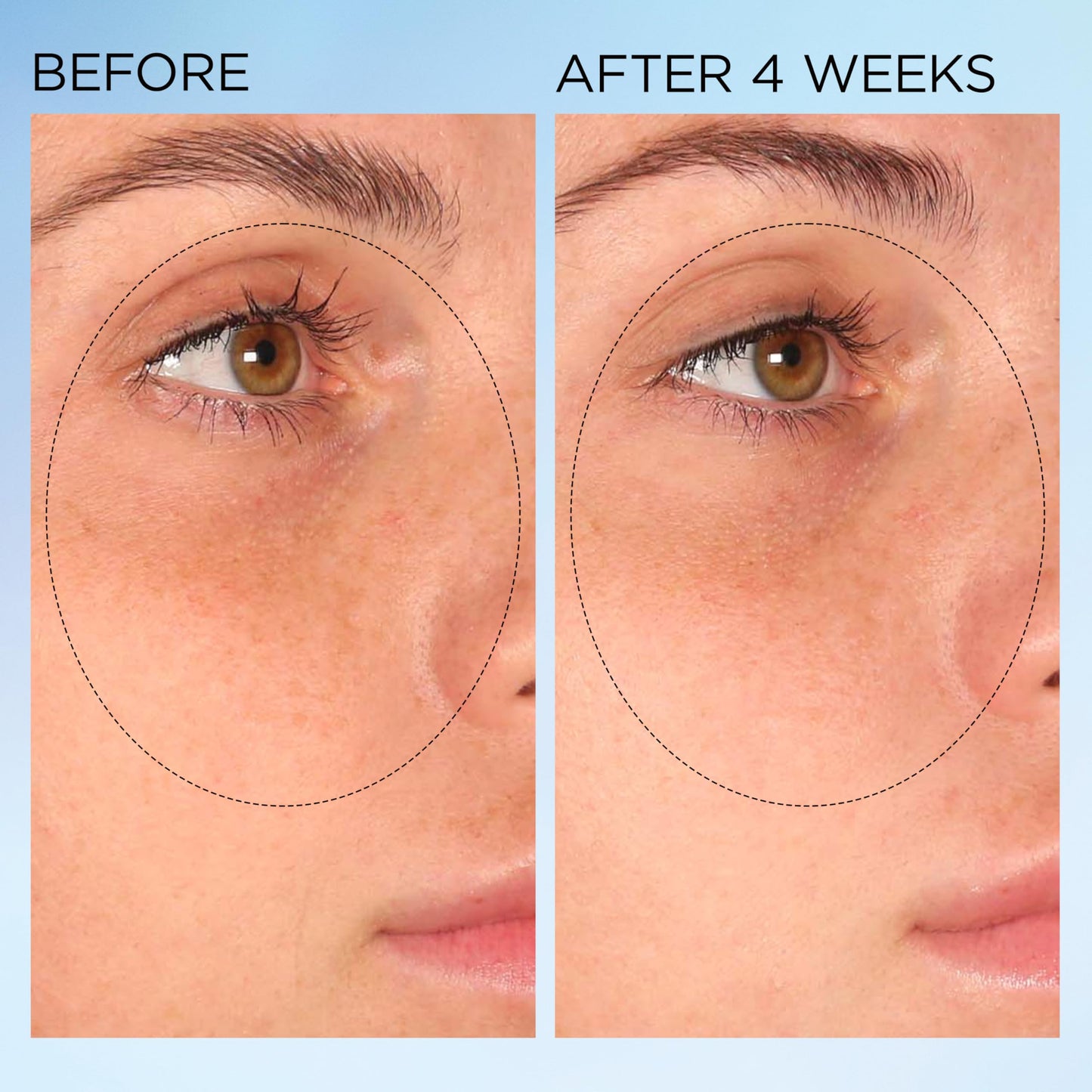Elizabeth Arden Visible Brightening Clearly Radiant Dark Spot Corrector & Vitamin C Serum Capsules, Corrects Post-Acne Scars, Reduces Pores & Evens Skin Tone