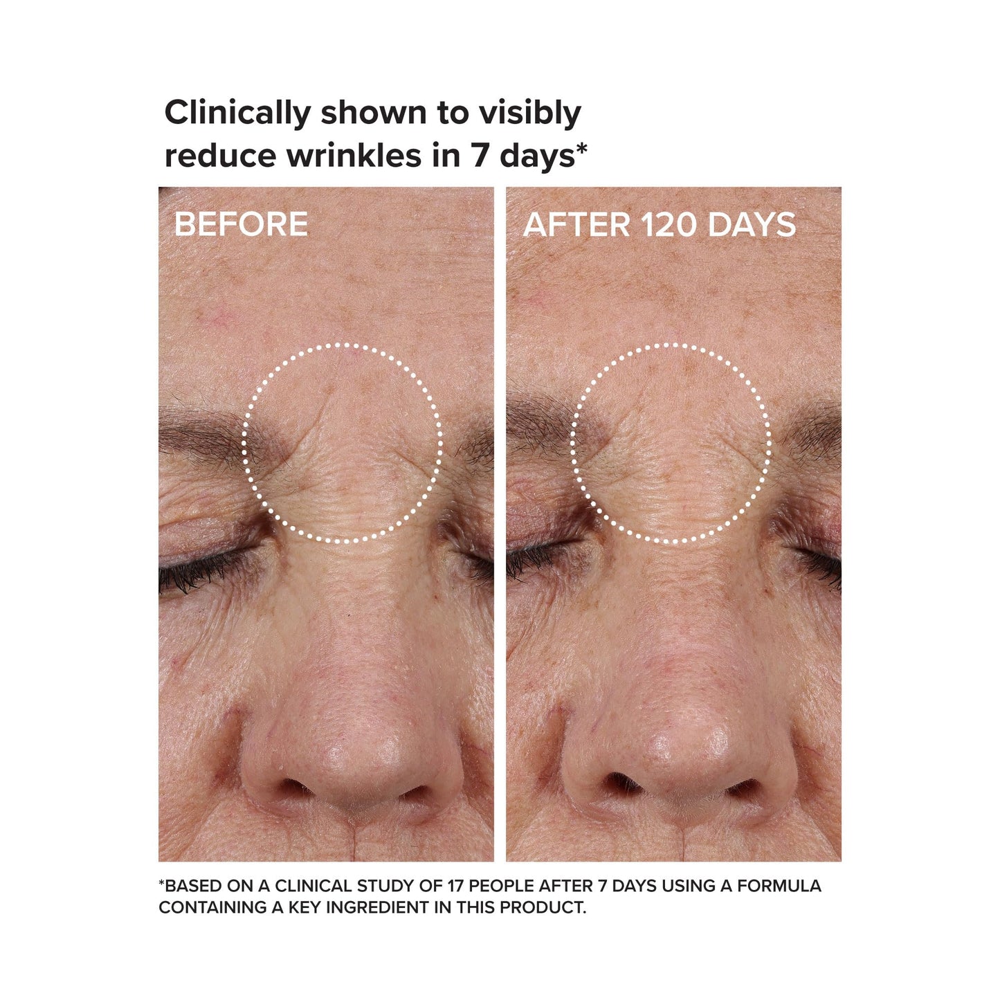 DRMTLGY Needle-less Growth Factor Serum for Face – Multi-Peptide & Hyaluronic Acid Facial Serum, Firming & Lifting, Skin Barrier Support & Wrinkle Care